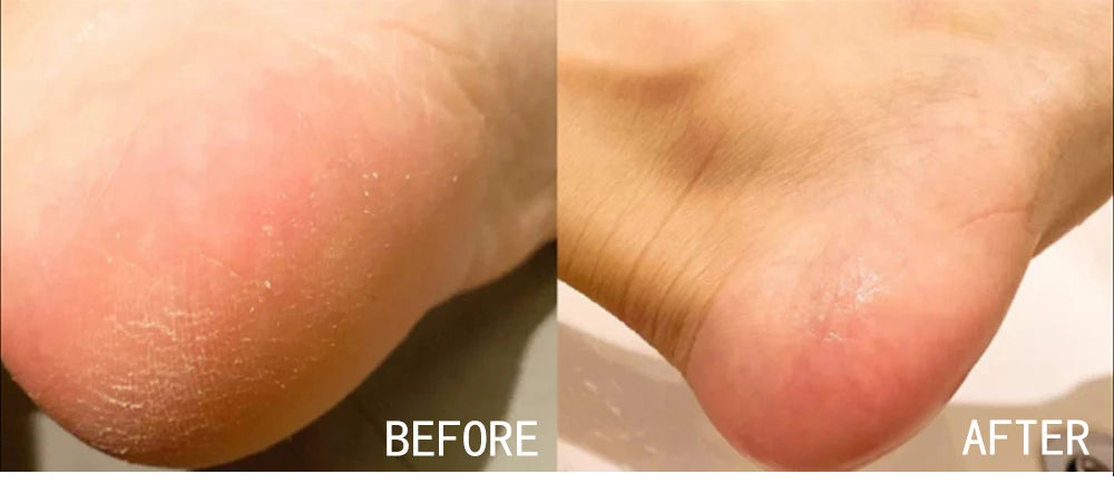 AILKE Vitamin C Brightening Cream Hydrating Face and Body Lotion