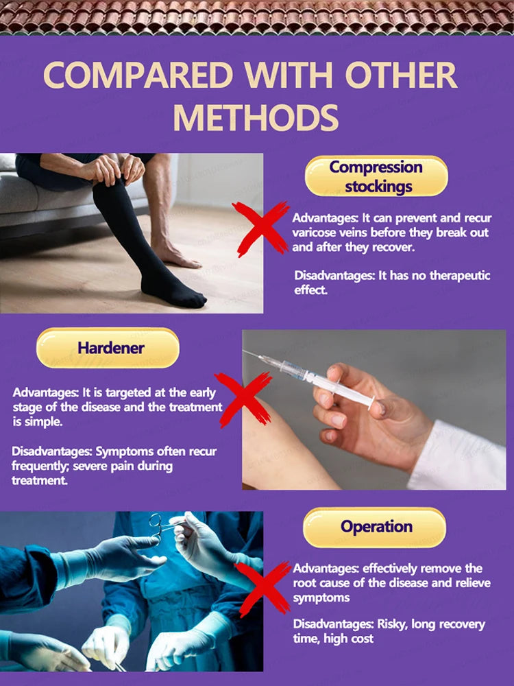 Leg massage tool, relax, veins no longer feel tight