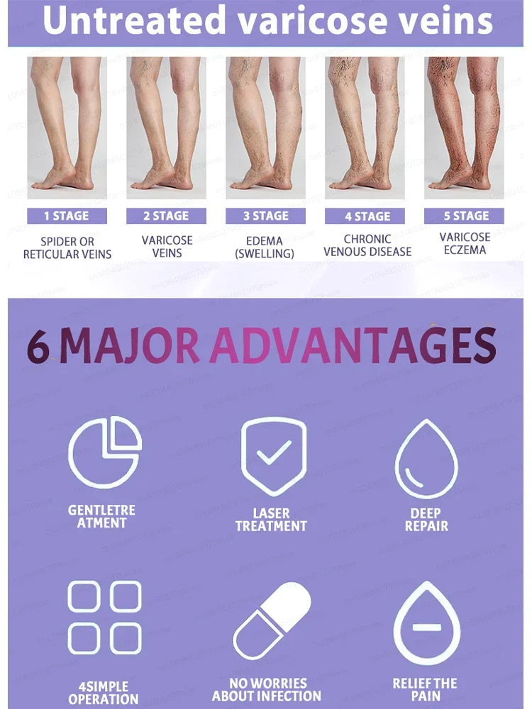 Leg massage tool, relax, veins no longer feel tight