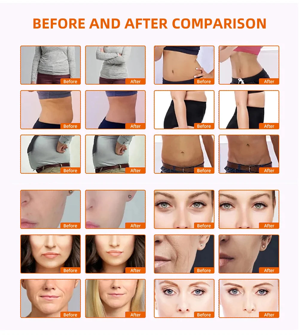 Skinterest Cavitation Vibration Skin Rejuvenation Tightening Machine