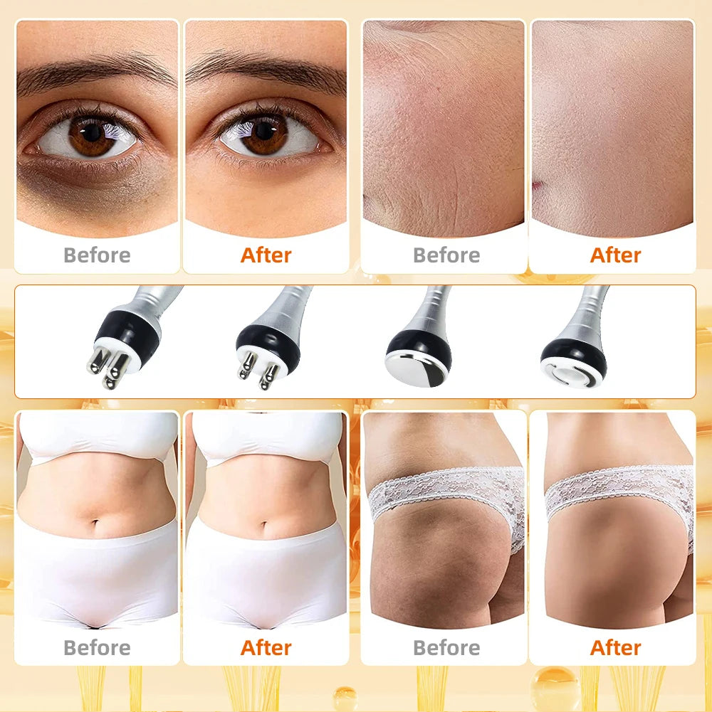 MISSHEARTH 4 In 1 Cavitation Ultrasonic Slimming Machine